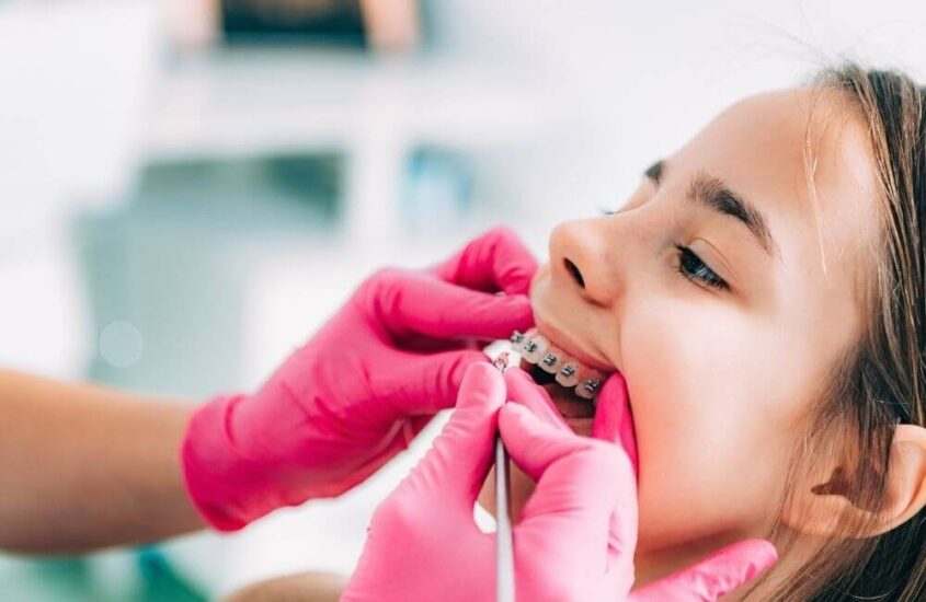 Kiedy założyć dziecku stały aparat na zęby? Wskazania i zalecenia