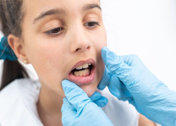 dziewczynka u dentysty