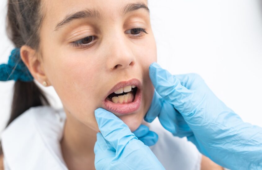 Zgrzytanie zębami u dzieci – przyczyny tej dolegliwości